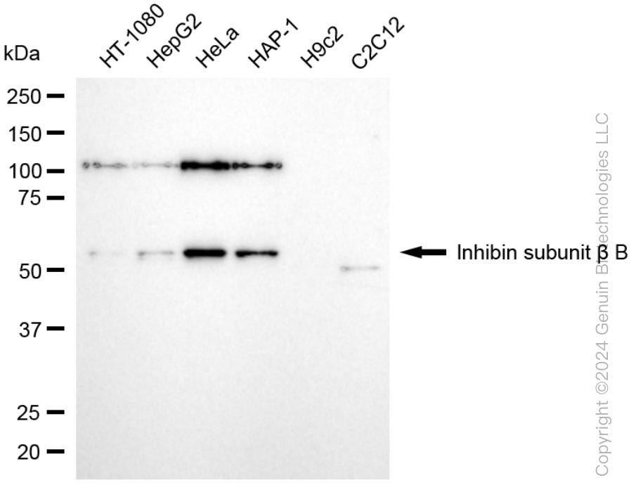 KD-Validated Anti-Inhibin subunit beta B Rabbit Monoclonal Antibody ABG1062