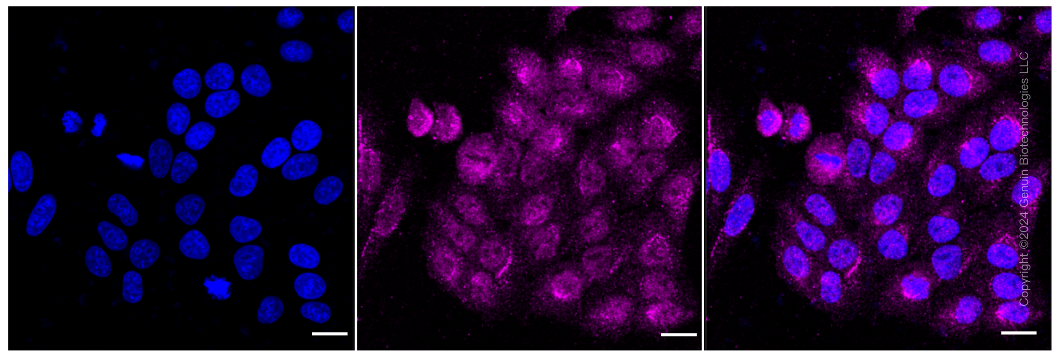 KD-Validated Anti-Gli3 Rabbit Monoclonal Antibody ABG1063