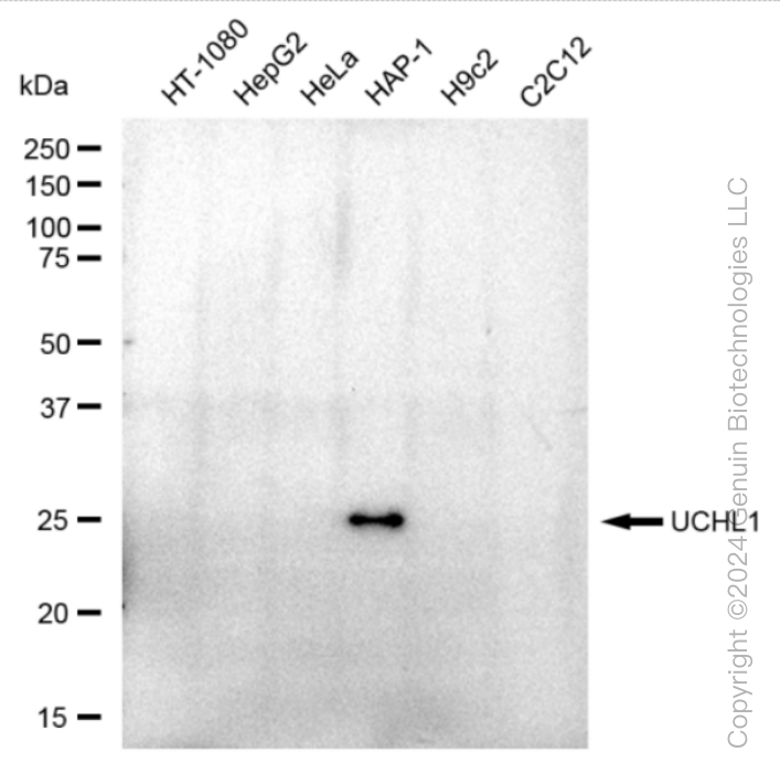 KD-Validated Anti-UCHL1 Rabbit Monoclonal Antibody ABG1066