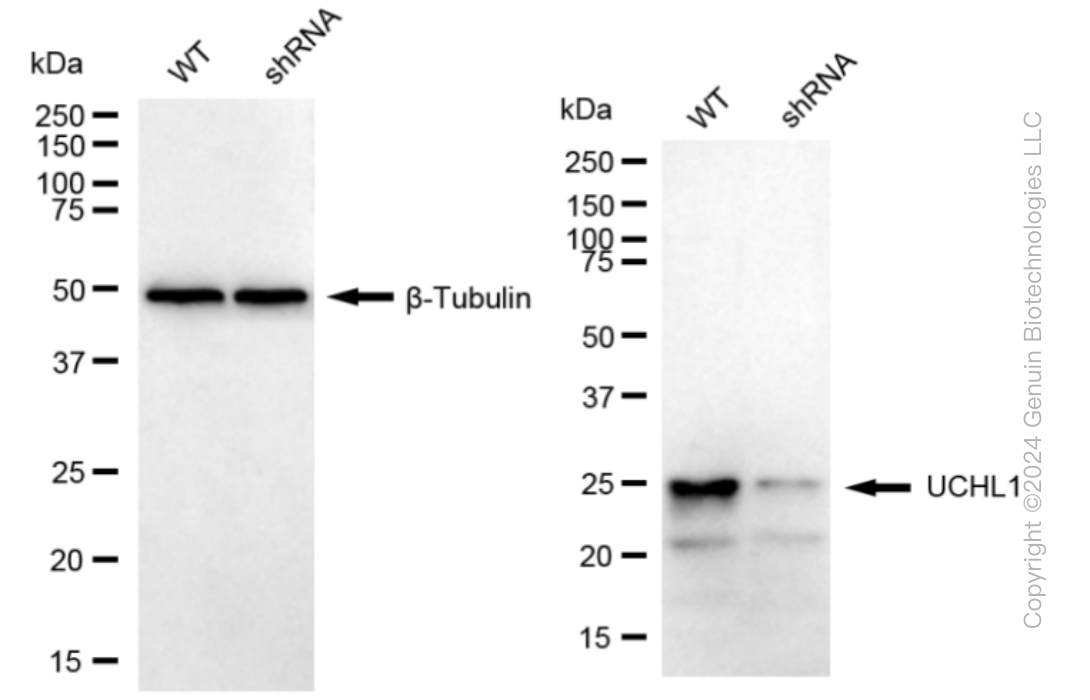 KD-Validated Anti-UCHL1 Rabbit Monoclonal Antibody ABG1066