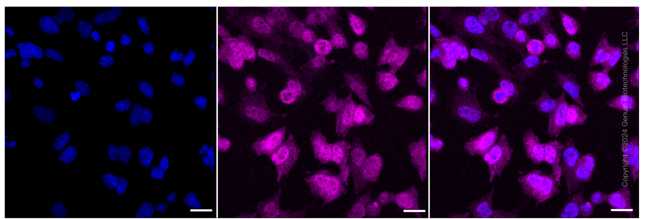 KD-Validated Anti-Galectin 3 Rabbit Monoclonal Antibody ABG1067