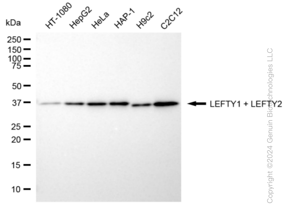 KD-Validated Anti-LEFTY1 + LEFTY2 Rabbit Monoclonal Antibody ABG1068