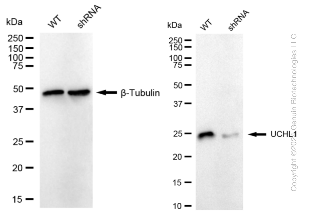 KD-Validated Anti-UCHL1 Rabbit Monoclonal Antibody ABG1069