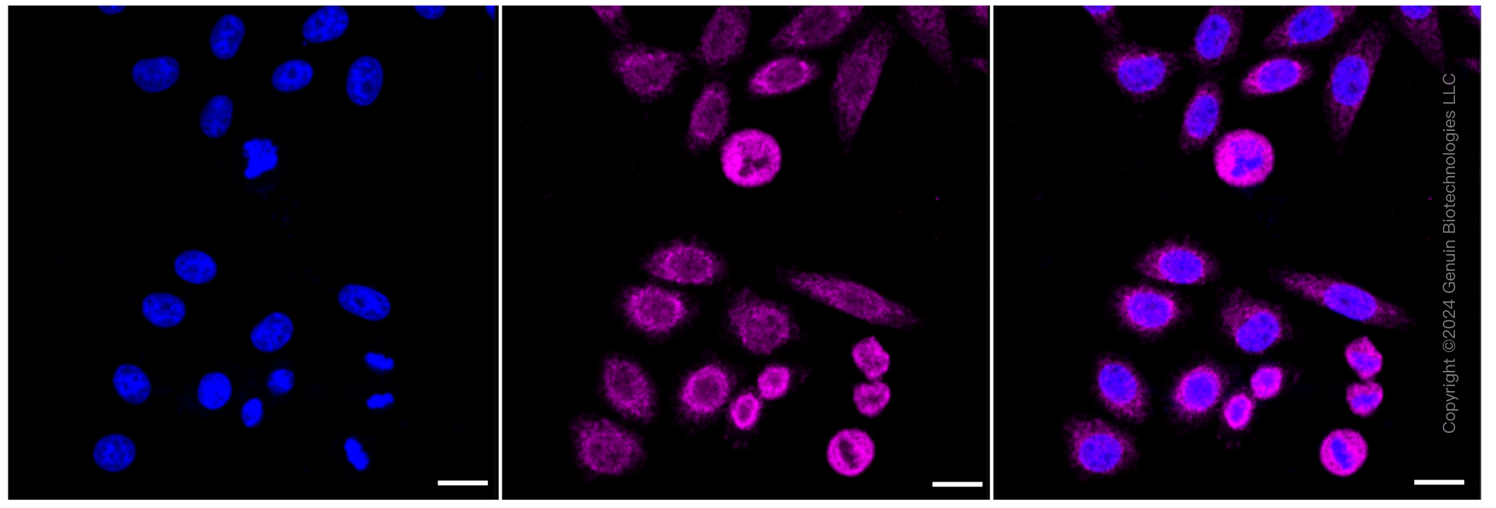 KD-Validated Anti-NDUFS3 Rabbit Monoclonal Antibody ABG1071
