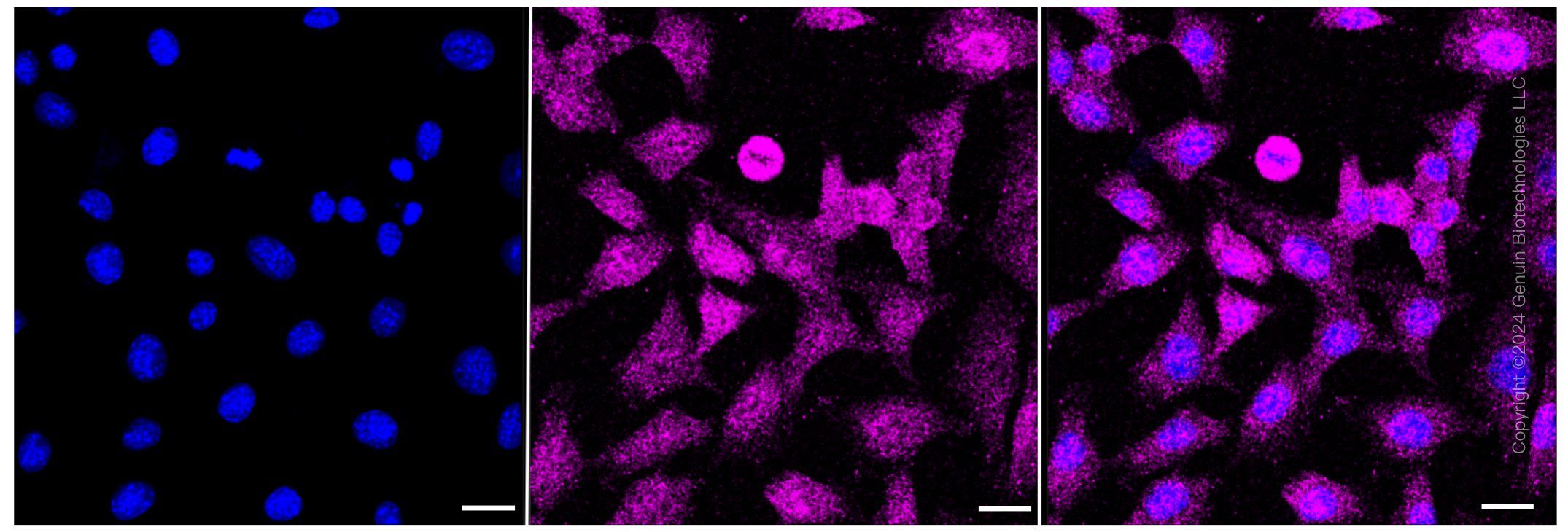 KD-Validated Anti-CRABP1 Rabbit Monoclonal Antibody ABG1073