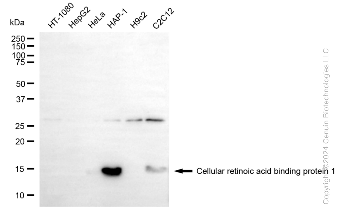 KD-Validated Anti-CRABP1 Rabbit Monoclonal Antibody ABG1073