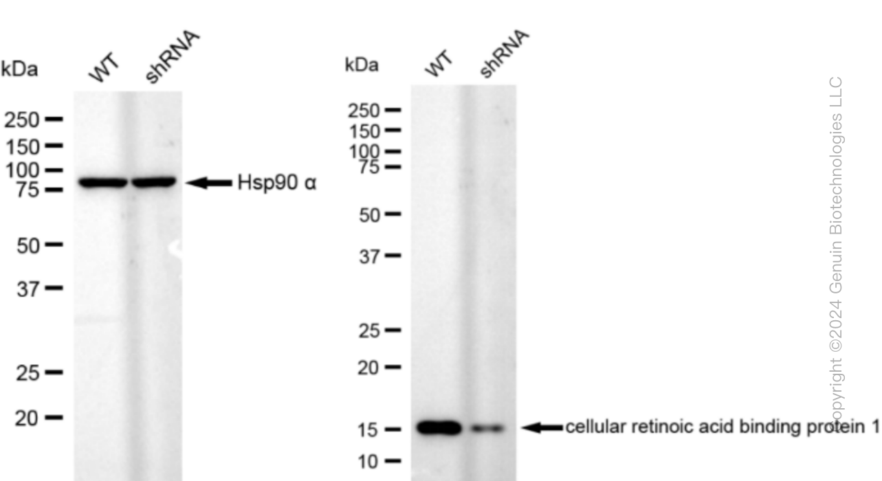 KD-Validated Anti-CRABP1 Rabbit Monoclonal Antibody ABG1073