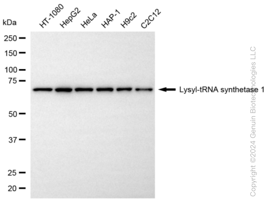 KD-Validated Anti-Lysyl-tRNA synthetase 1 Rabbit Monoclonal Antibody ABG1074