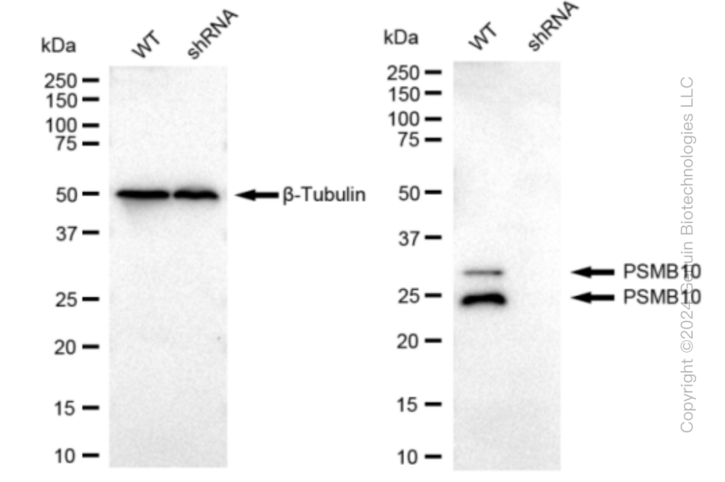 KD-Validated Anti-PSMB10 Rabbit Monoclonal Antibody ABG1075