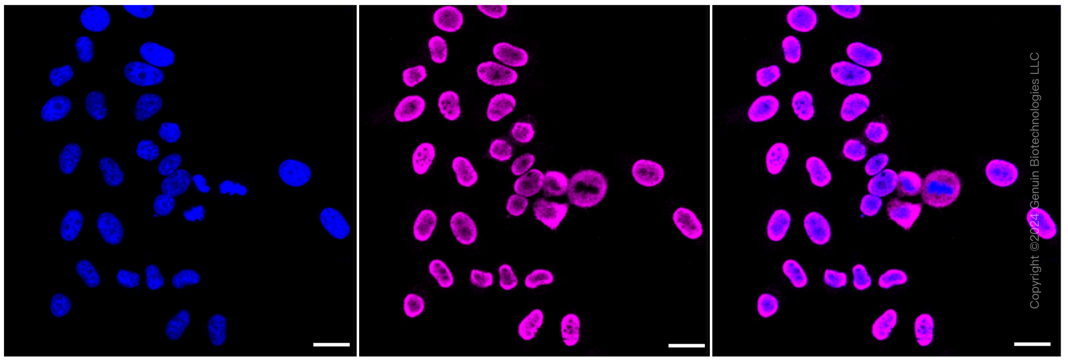 KD-Validated Anti-NME1 Rabbit Monoclonal Antibody ABG1078