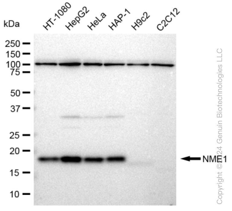 KD-Validated Anti-NME1 Rabbit Monoclonal Antibody ABG1078