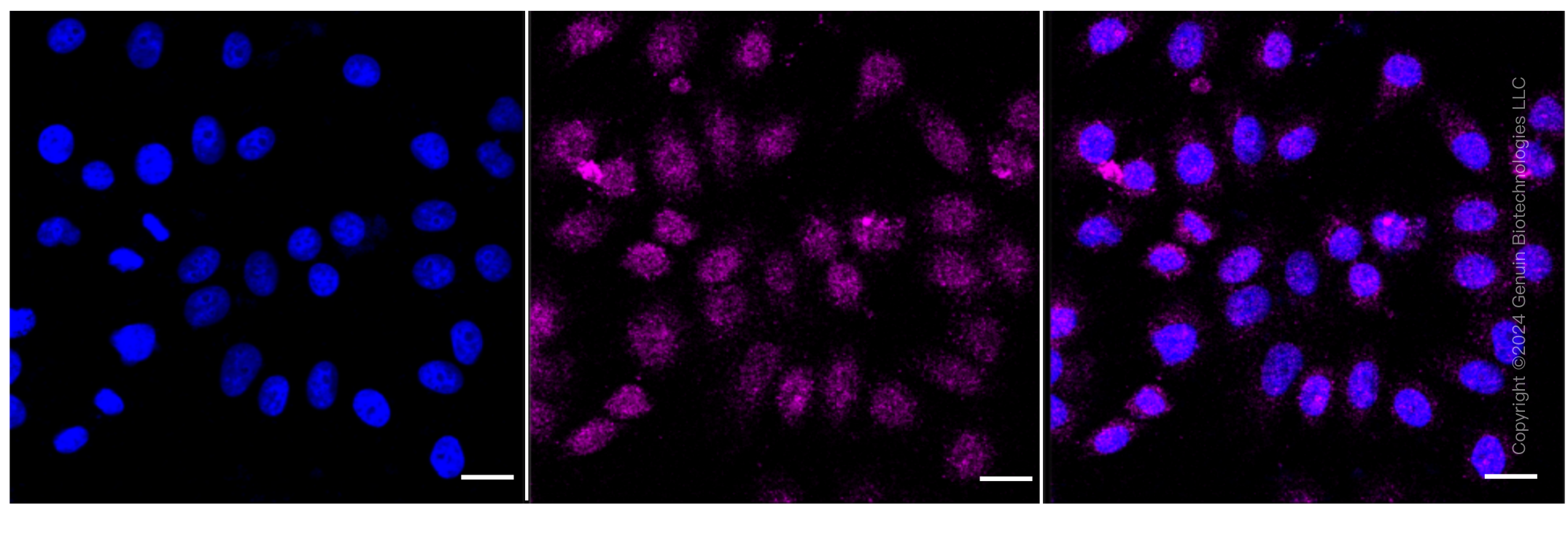 KD-Validated Anti-Pancreatic proteinase 1 Rabbit Monoclonal Antibody ABG1080
