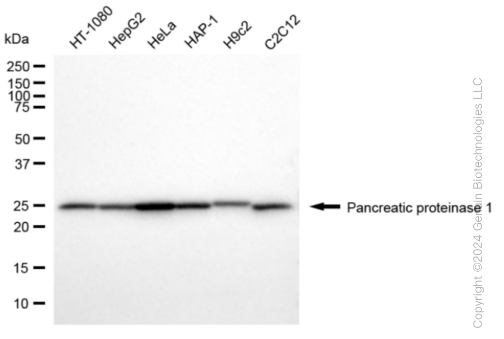KD-Validated Anti-Pancreatic proteinase 1 Rabbit Monoclonal Antibody ABG1080