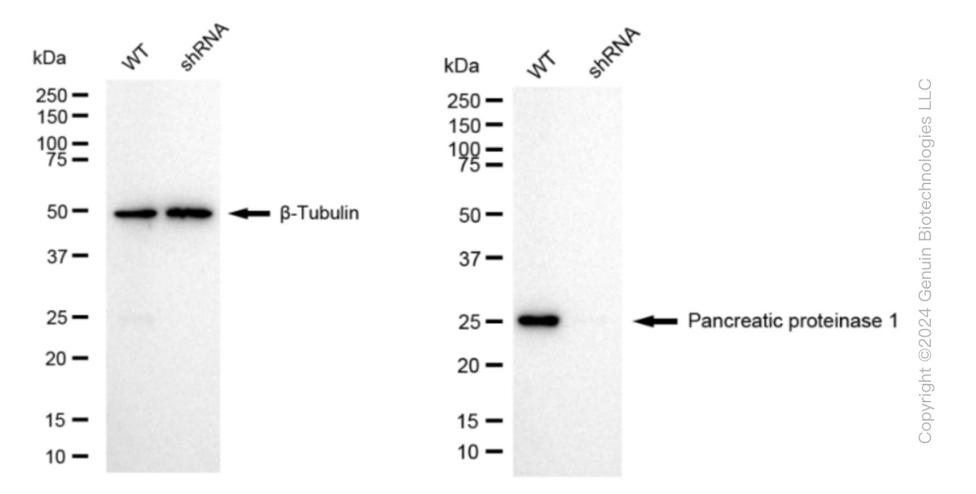 KD-Validated Anti-Pancreatic proteinase 1 Rabbit Monoclonal Antibody ABG1080