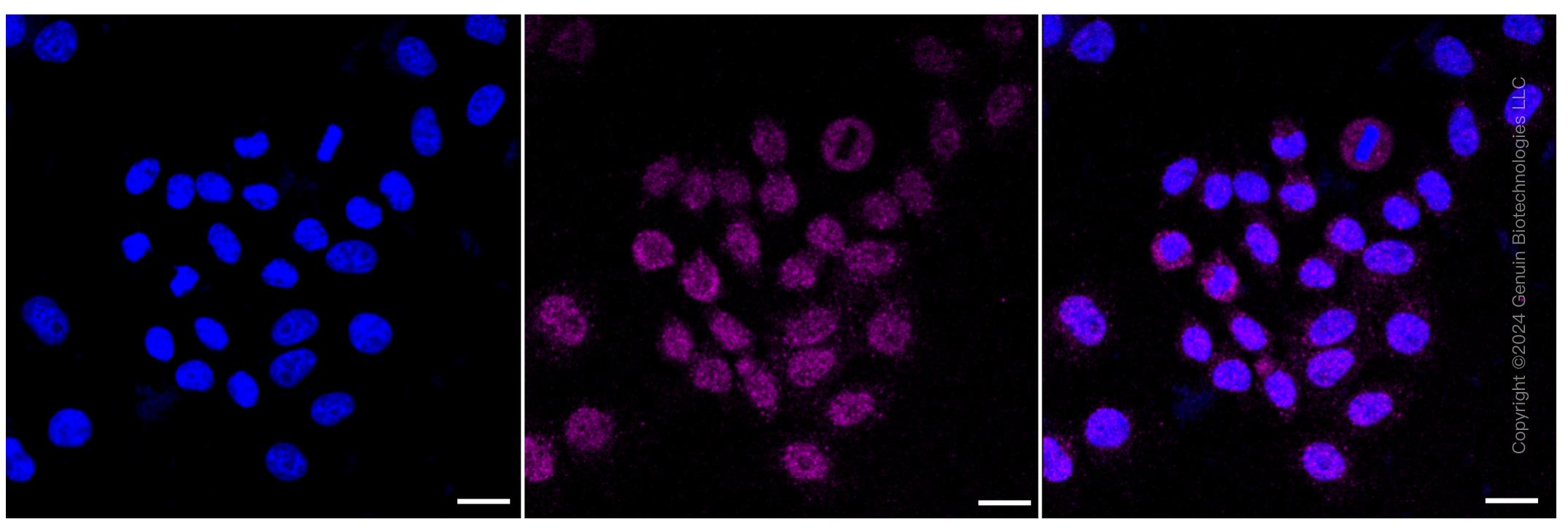 KD-Validated Anti-NME1 Rabbit Monoclonal Antibody ABG1081