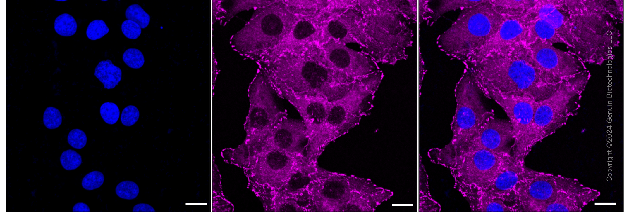 KD-Validated Anti-Vinculin Rabbit Monoclonal Antibody ABG1083