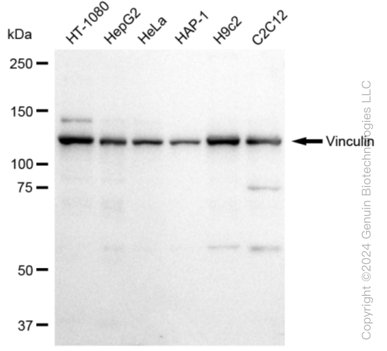 KD-Validated Anti-Vinculin Rabbit Monoclonal Antibody ABG1083