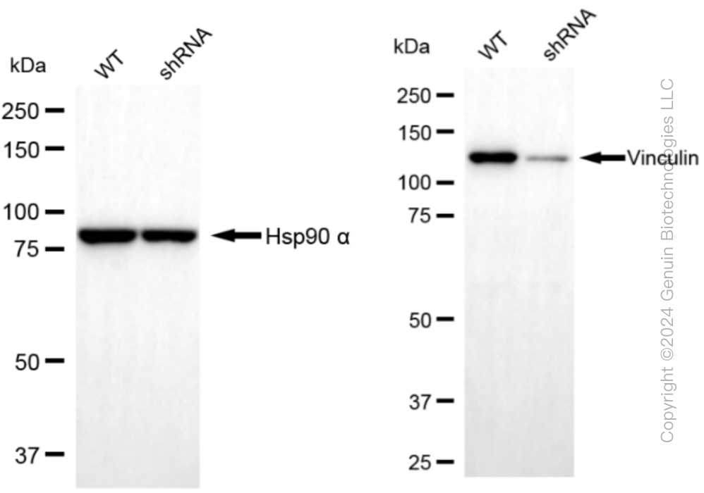 KD-Validated Anti-Vinculin Rabbit Monoclonal Antibody ABG1083