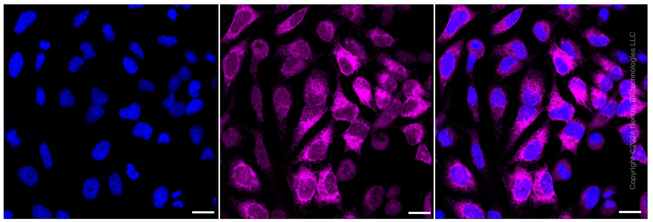 KD-Validated Anti-Integrin subunit alpha V Rabbit Monoclonal Antibody ABG1085