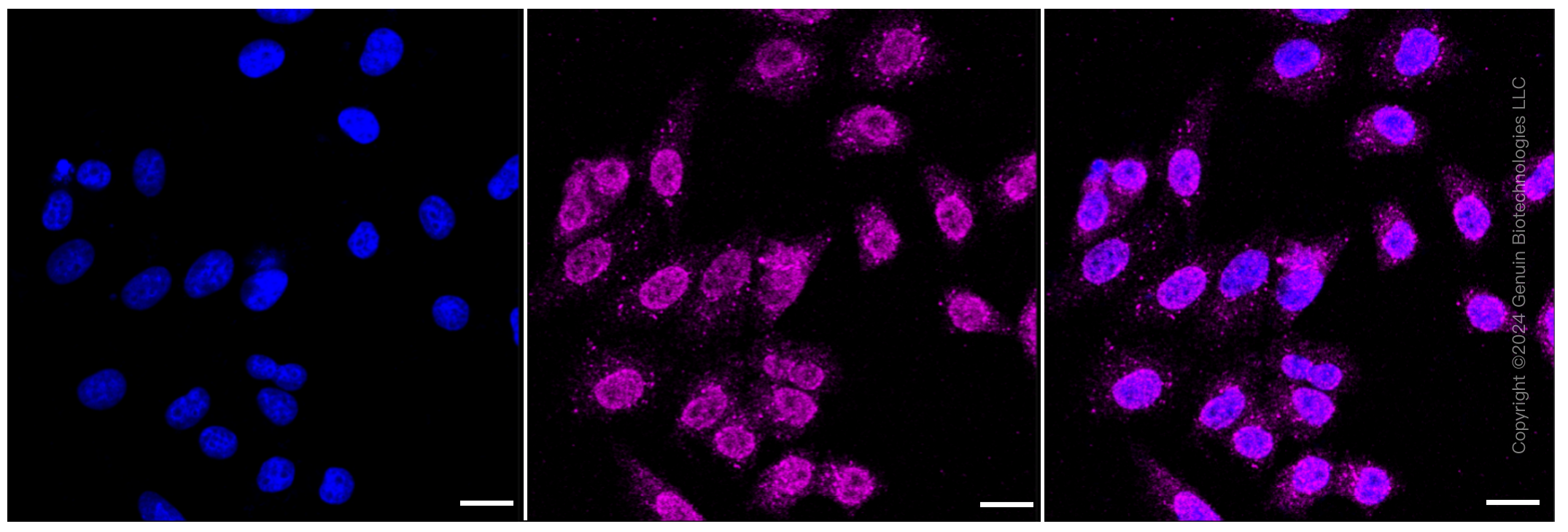 KD-Validated Anti-Janus kinase 1 Rabbit Monoclonal Antibody ABG1086