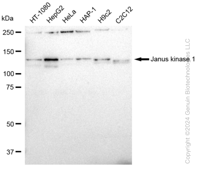 KD-Validated Anti-Janus kinase 1 Rabbit Monoclonal Antibody ABG1086