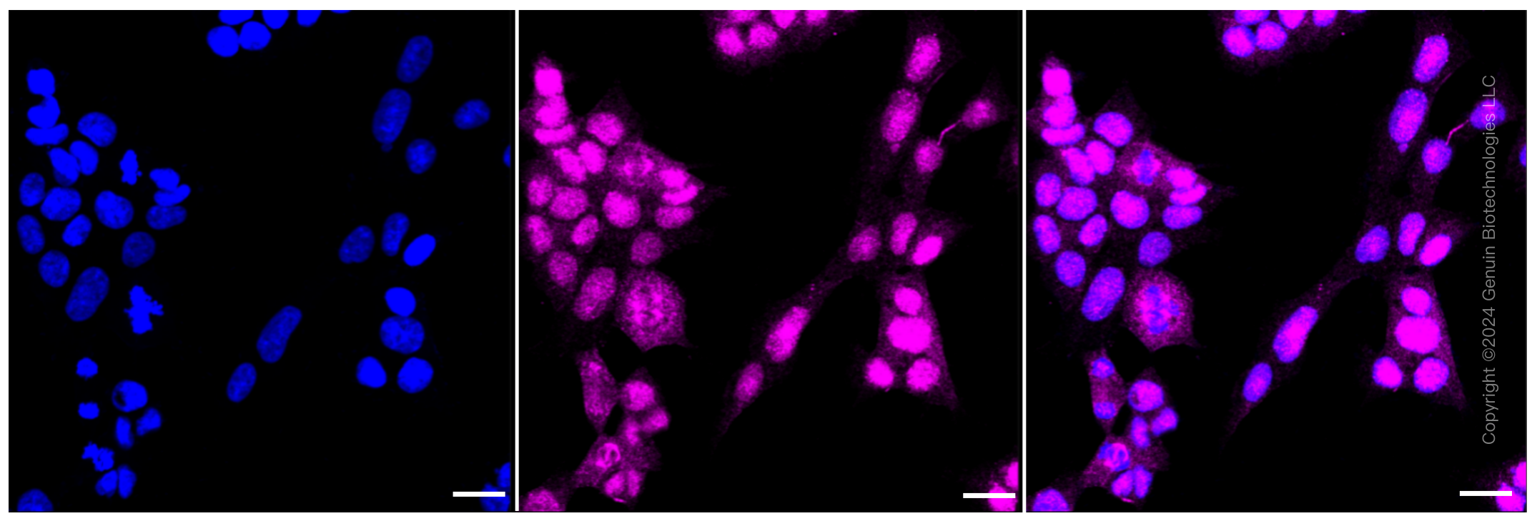 KD-Validated Anti-RAD51 Rabbit Monoclonal Antibody ABG1092