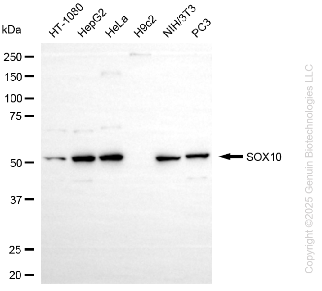 KD-Validated Anti-SRY-Box Transcription Factor 10 Rabbit Monoclonal Antibody ABG1096