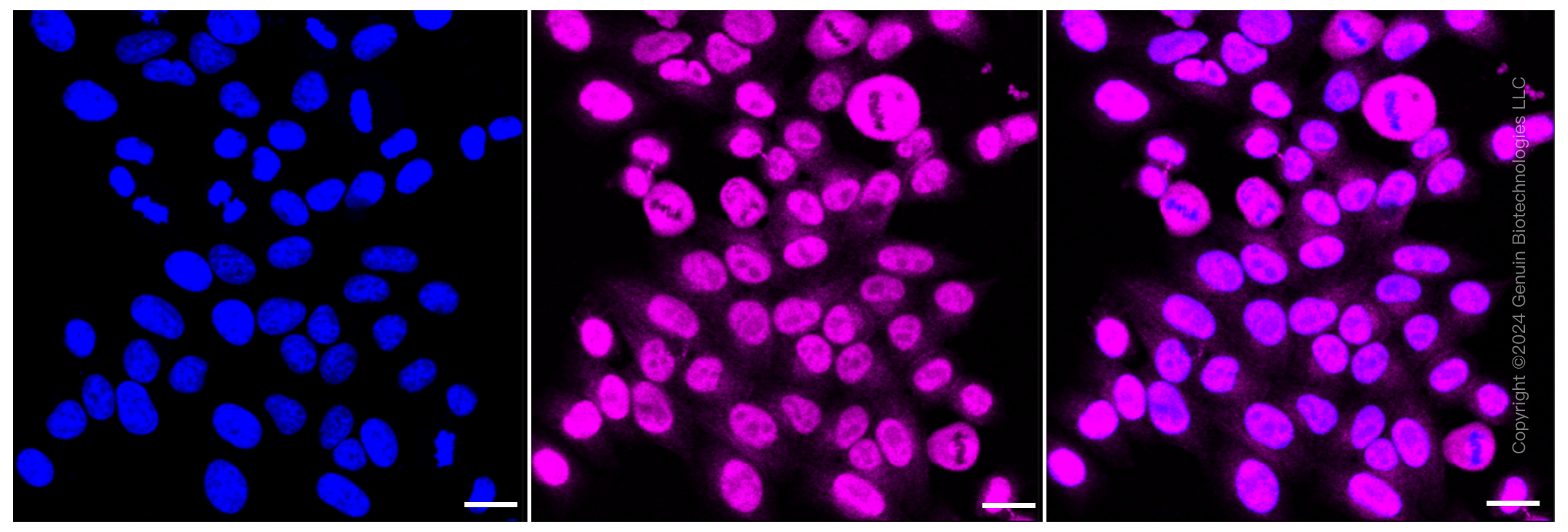 KD-Validated Anti-Transcription elongation factor A1 Rabbit Monoclonal Antibody ABG1101