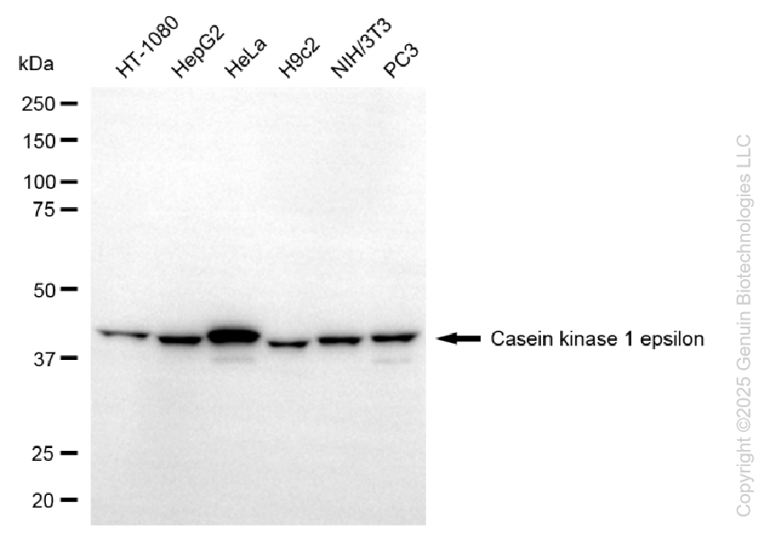 KD-Validated Anti-CSNK1E mouse monoclonal antibody ABG1106