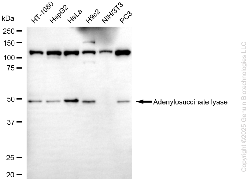 KD-Validated Anti-Adenylosuccinate Lyase Mouse Monoclonal Antibody ABG1110