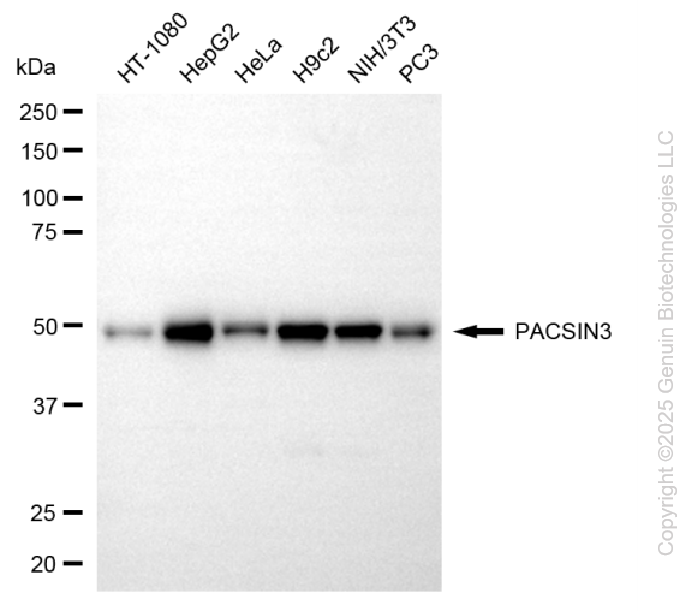 KD-Validated Anti-PACSIN3 Mouse Monoclonal Antibody ABG1113