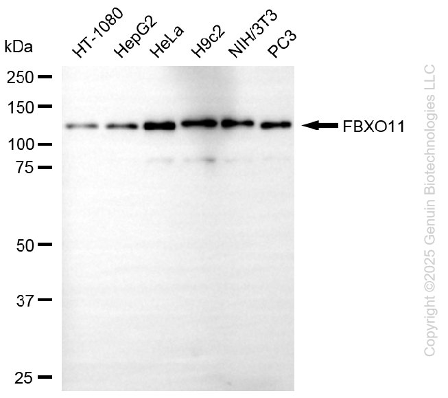 KD-Validated Anti-F-Box Protein 11 Mouse Monoclonal Antibody ABG1116
