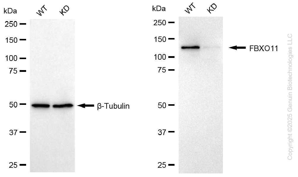 KD-Validated Anti-F-Box Protein 11 Mouse Monoclonal Antibody ABG1116