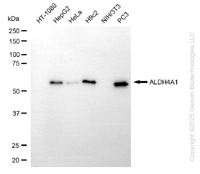 KD-Validated Anti-ALDH4A1 Mouse Monoclonal Antibody ABG1117