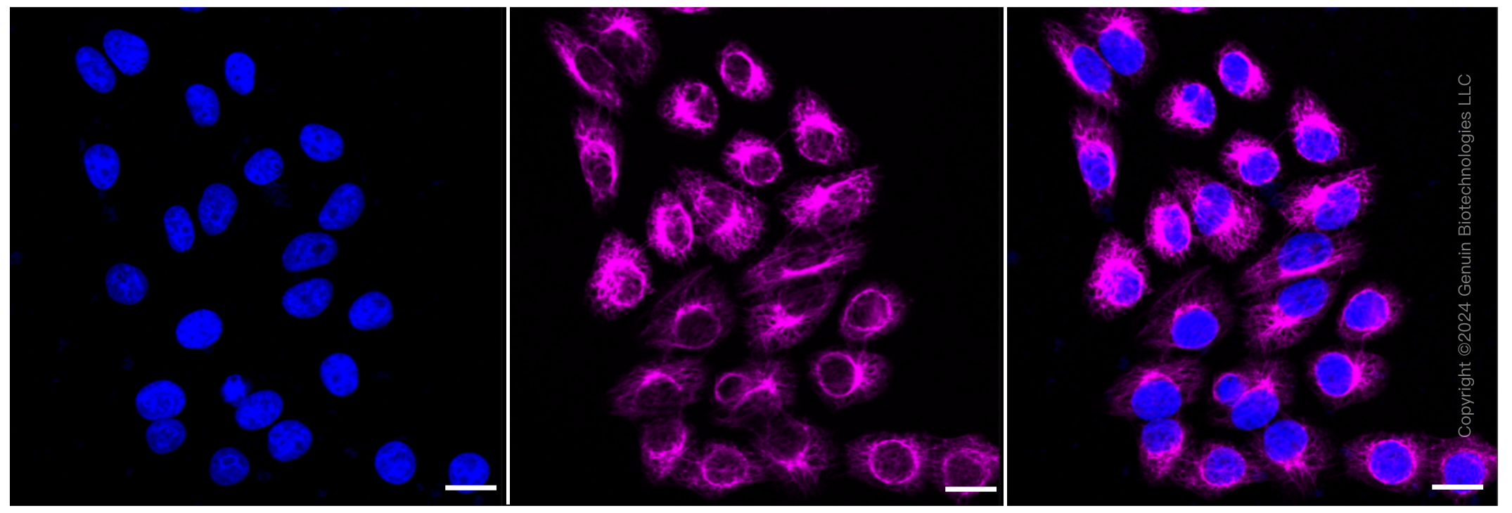 KD-Validated Anti-Keratin 7 Rabbit Monoclonal Antibody ABG1121