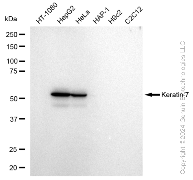KD-Validated Anti-Keratin 7 Rabbit Monoclonal Antibody ABG1121