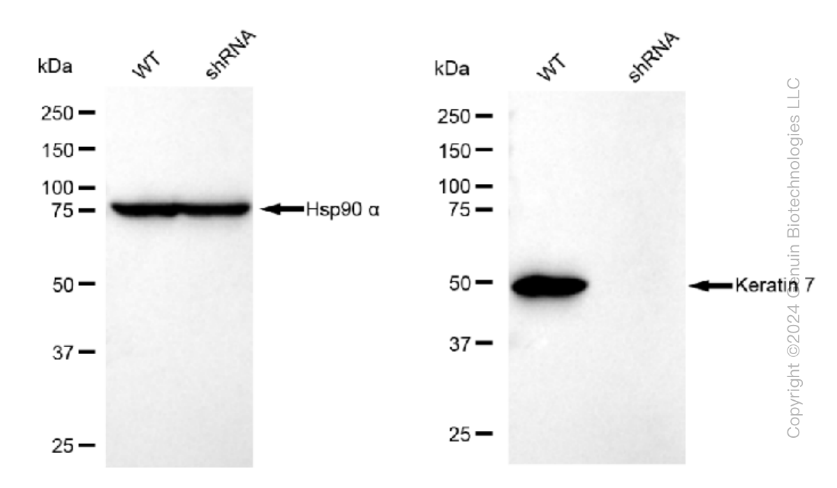 KD-Validated Anti-Keratin 7 Rabbit Monoclonal Antibody ABG1121