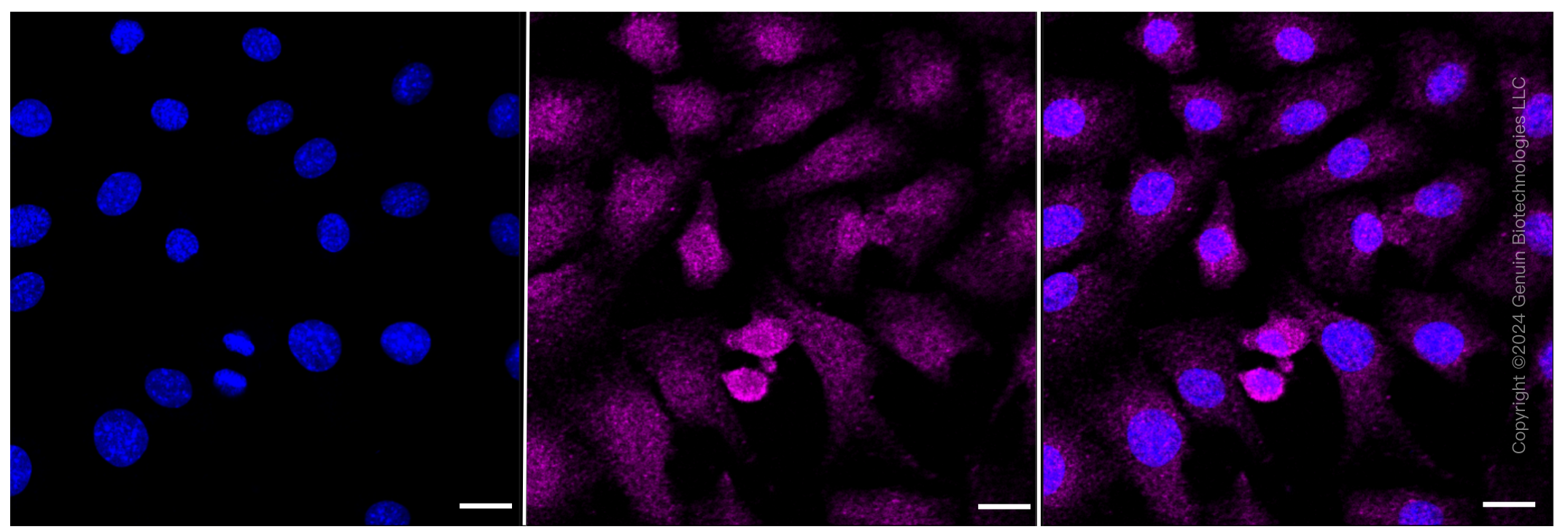 KD-Validated Anti-AdSS 2 Rabbit Monoclonal Antibody ABG1122