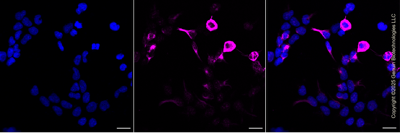 KD-Validated Anti-Phospho-Vimentin (Ser56) Rabbit Monoclonal Antibody ABG1123