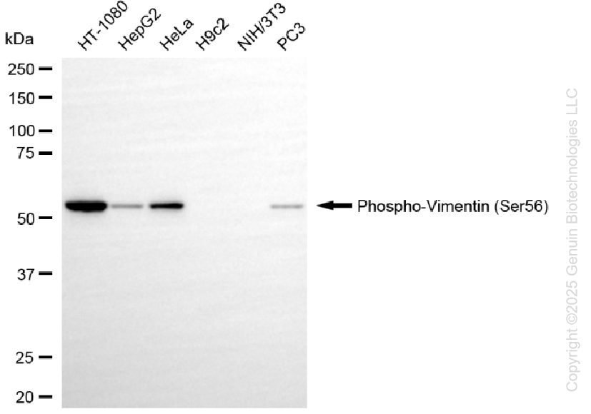 KD-Validated Anti-Phospho-Vimentin (Ser56) Rabbit Monoclonal Antibody ABG1123