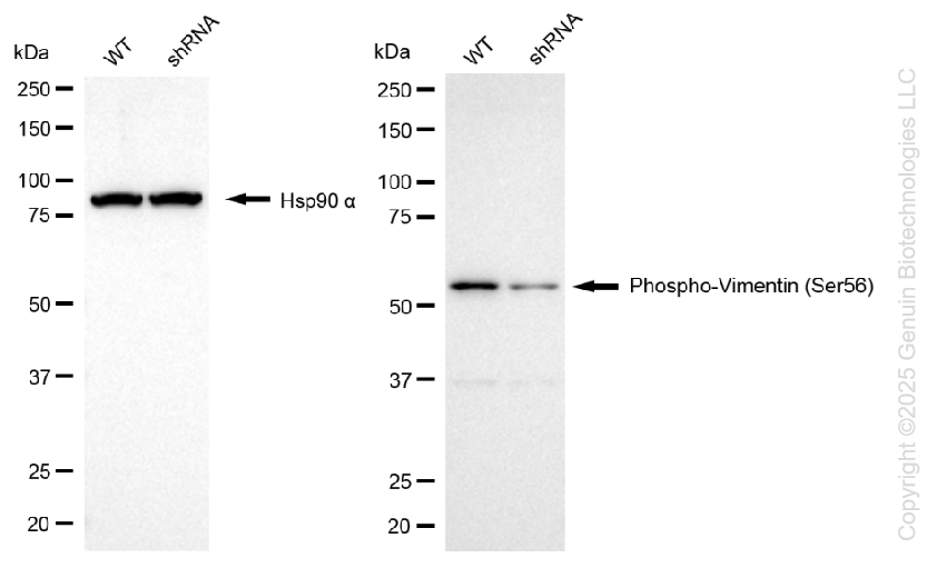 KD-Validated Anti-Phospho-Vimentin (Ser56) Rabbit Monoclonal Antibody ABG1123