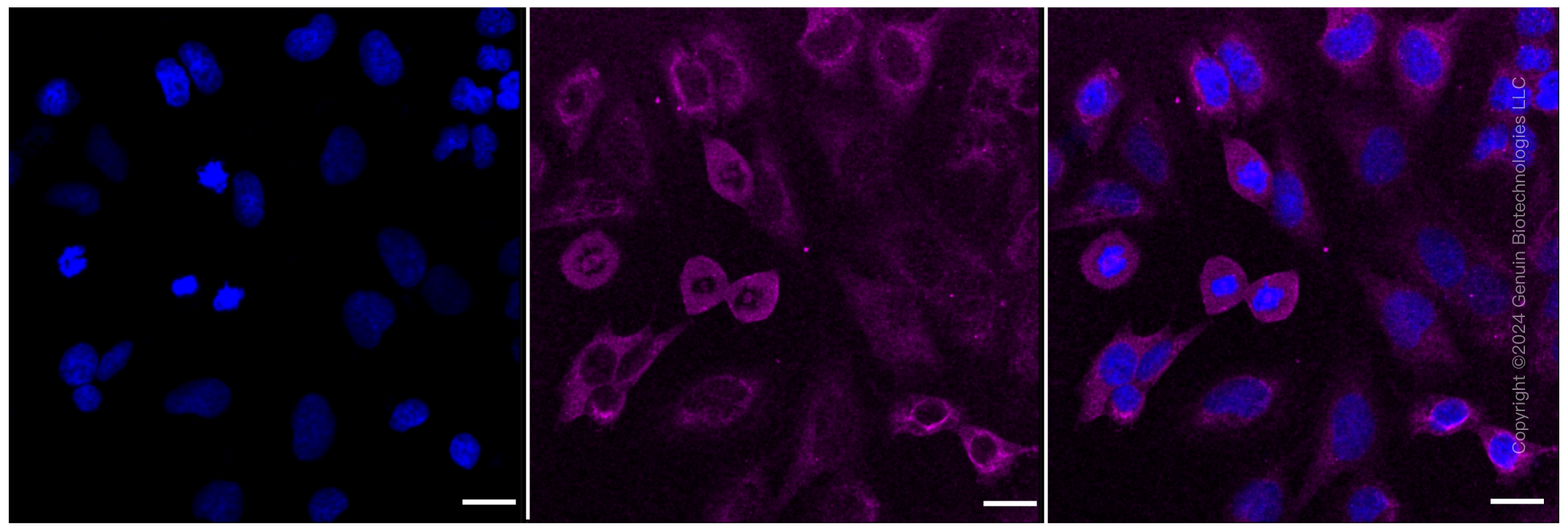 KD-Validated Anti-PPP3CA Rabbit Monoclonal Antibody ABG1124