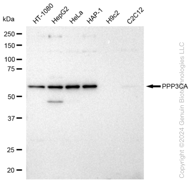 KD-Validated Anti-PPP3CA Rabbit Monoclonal Antibody ABG1124