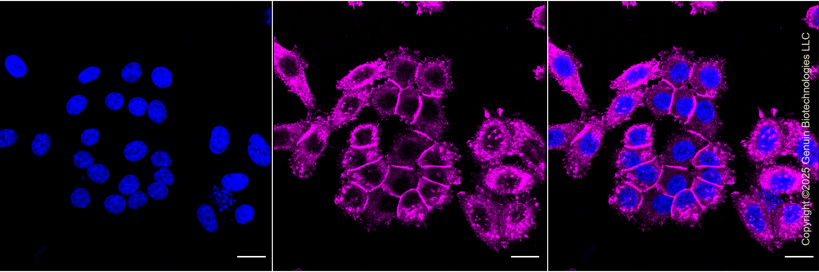 KD-Validated Anti-IQGAP1 Rabbit Monoclonal Antibody ABG1125