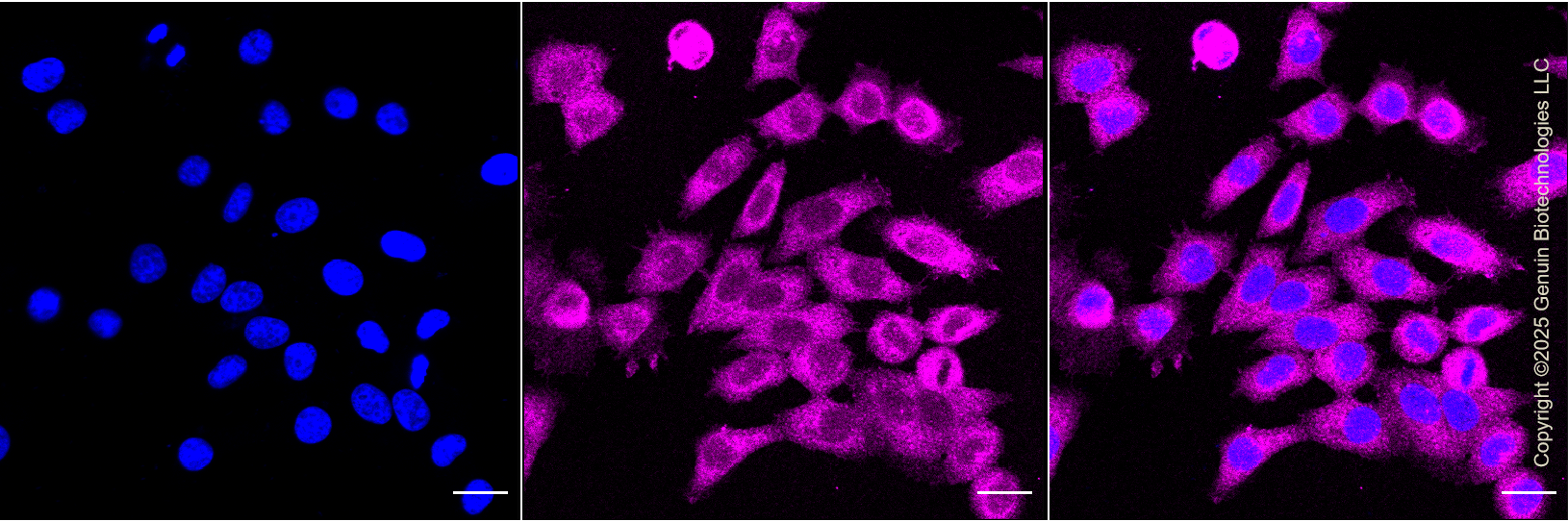 KD-Validated Anti-Mannose Receptor (CD206) Rabbit Monoclonal Antibody ABG1126