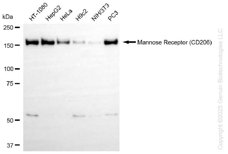 KD-Validated Anti-Mannose Receptor (CD206) Rabbit Monoclonal Antibody ABG1126