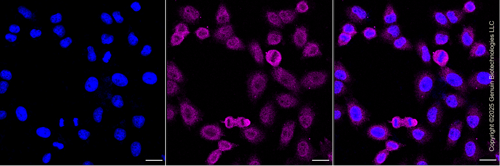 KD-Validated Anti-ROCK1 Rabbit Monoclonal Antibody ABG1127