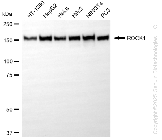 KD-Validated Anti-ROCK1 Rabbit Monoclonal Antibody ABG1127