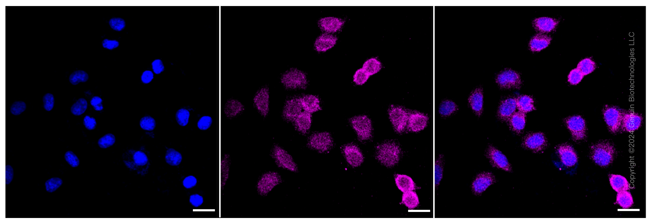 KD-Validated Anti-MAP2K1 Rabbit Monoclonal Antibody ABG1132