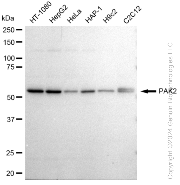 KD-Validated Anti-PAK2 Rabbit Monoclonal Antibody ABG1137